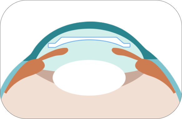 Microscopic view of a virus particle