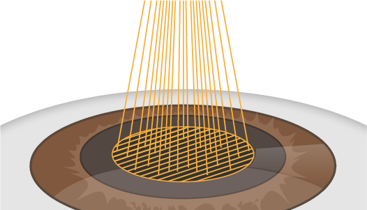 Microscopic view of a virus particle