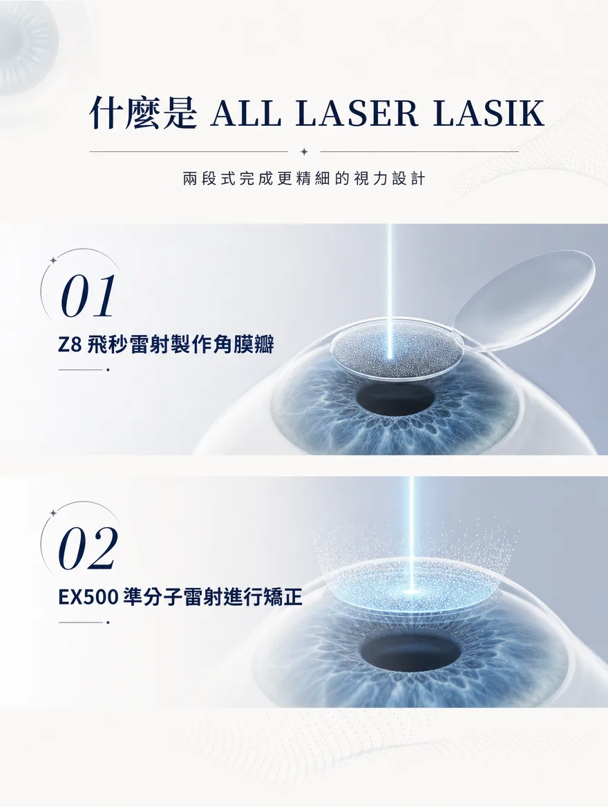 全雷射LASIK — 什麼是 ALL LASER LASIK — 兩段式完成更精細的視力設計：01 Z8飛秒雷射製作角膜瓣、02 EX500準分子雷射進行矯正。
