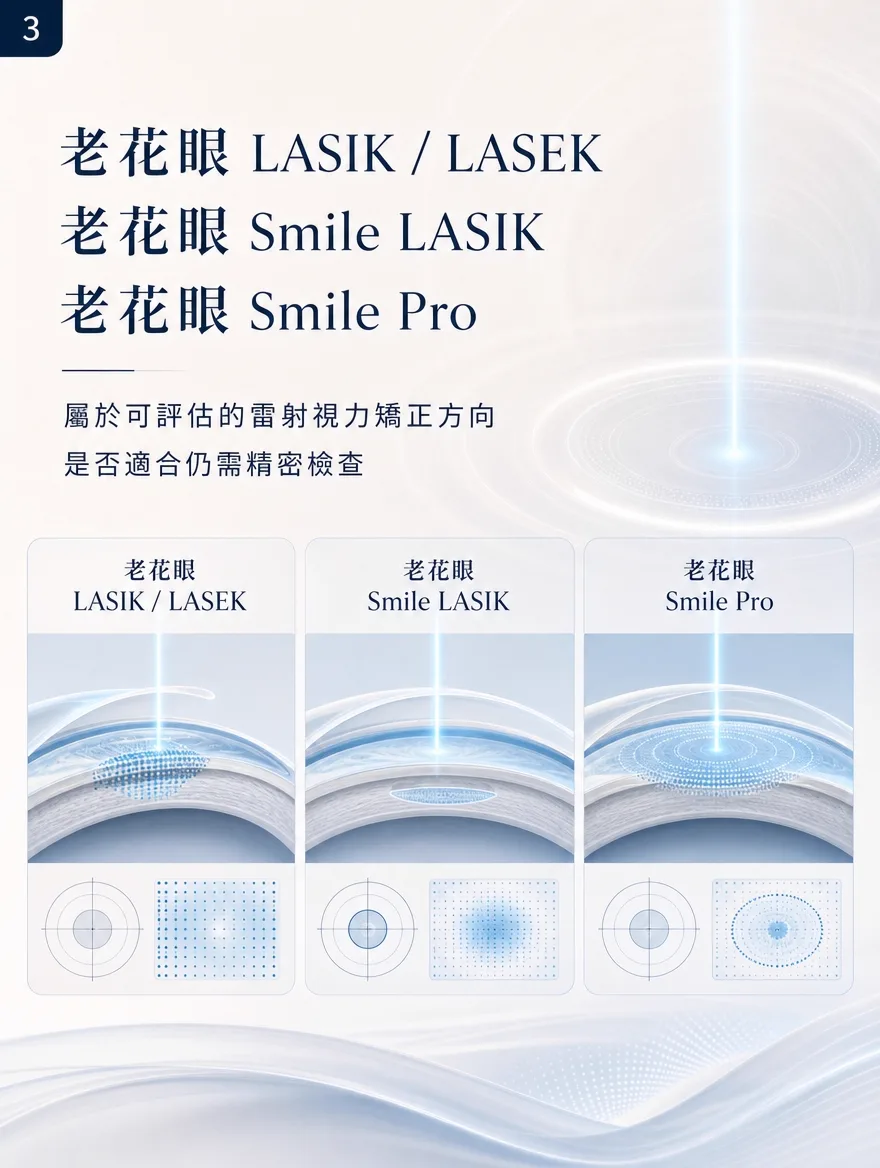 老花視力矯正術 — 老花LASIK・LASEK、老花Smile LASIK、老花Smile Pro——可評估的雷射視力矯正方向 — 透過精密削切角膜、重新調整焦點的雷射視力矯正,也是可評估用於老花眼的方向。老花LASIK・LASEK、老花Smile LASIK、老花Smile Pro等選項,各自擁有不同的切削方式與恢復特性,若同時合併近視、散光,也可能一併納入矯正設計。不過並非所有眼睛都適用,是否適合仍需透過精密檢查確認角膜厚度與屈光狀態後再判斷。
