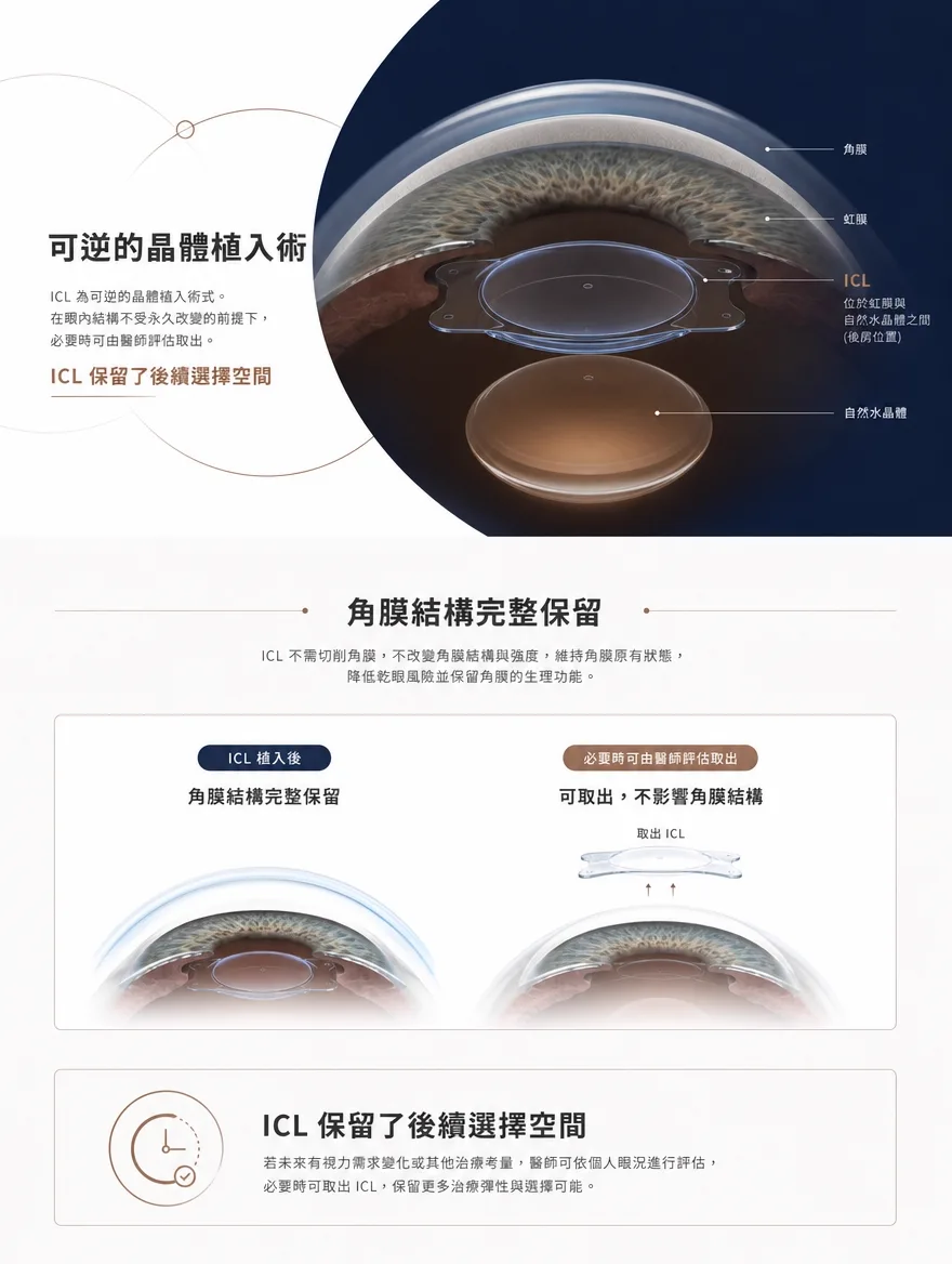 眼內鏡片植入術(ICL) — 可逆的晶體植入術 — ICL 為可逆的晶體植入術式。在眼內結構不受永久改變的前提下,必要時可由醫師評估取出。若未來有視力需求變化或其他治療考量,醫師可依個人眼況進行評估,保留更多治療彈性與選擇可能。