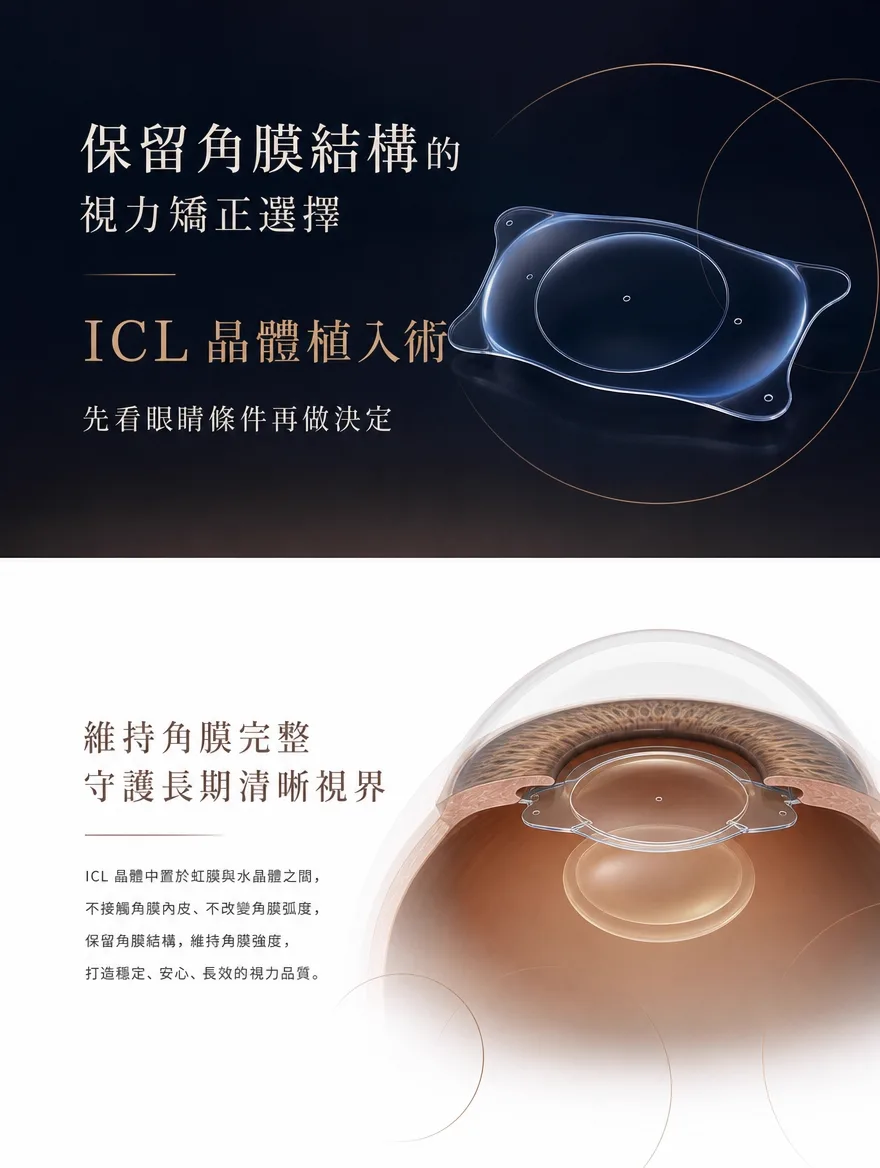 眼內鏡片植入術(ICL) — 保留角膜結構的視力矯正選擇 — ICL 晶體植入術 — 先看眼睛條件再做決定。ICL 晶體中置於虹膜與水晶體之間,不接觸角膜內皮、不改變角膜弧度,保留角膜結構,維持角膜強度,打造穩定、安心、長效的視力品質。