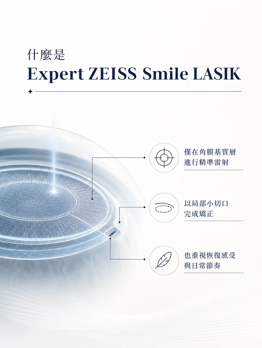 ZEISS SMILE LASIK — 什麼是 Expert ZEISS Smile LASIK — 僅在角膜基質層進行精準雷射．以局部小切口完成矯正．也重視恢復感受與日常節奏。